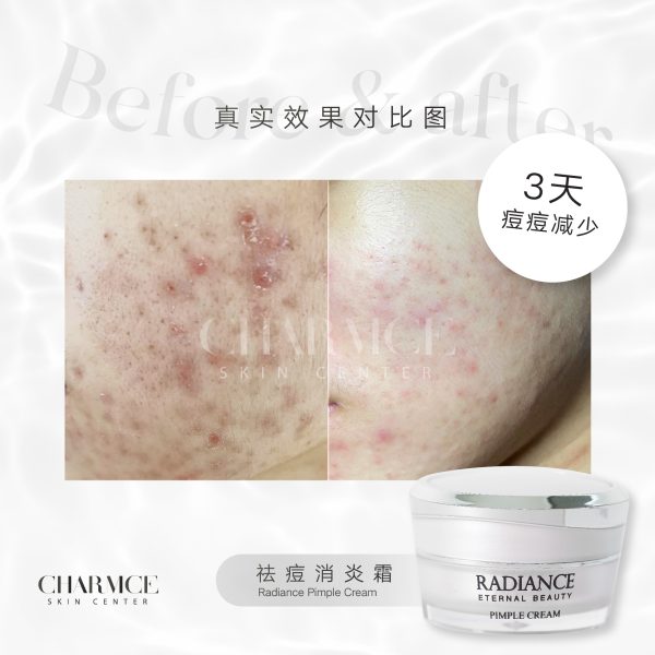 Radiance Pimple Cream 痘痘霜 10g - 图片 3